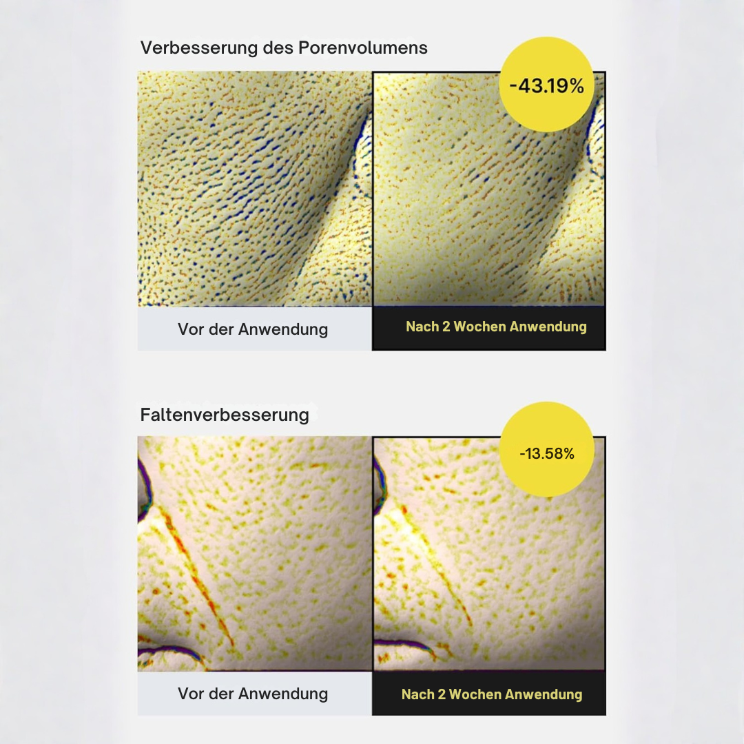 Vita-A Straffungspflege