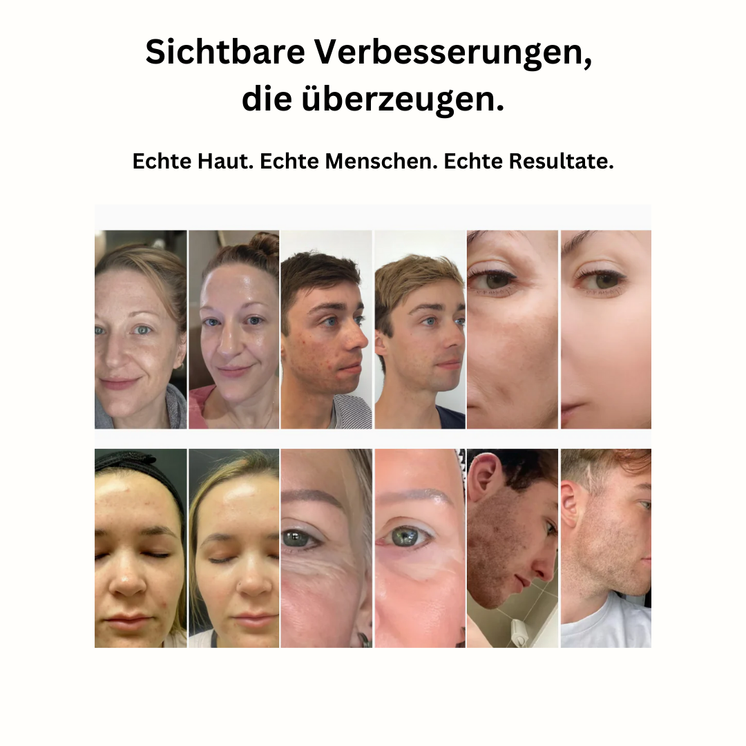 GlowSkin™ | Das virale Reispeeling für den wahren Glow