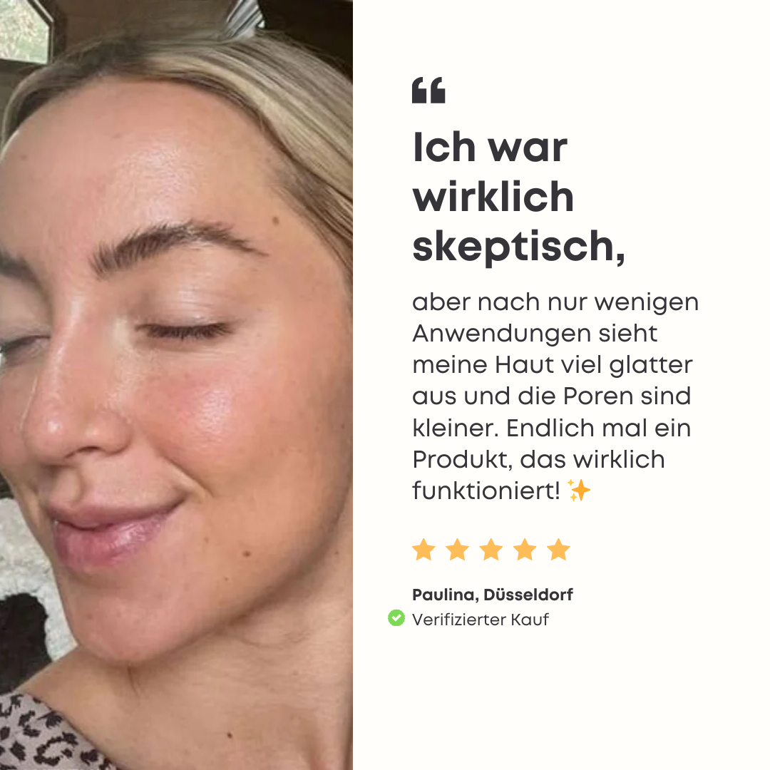 GlowSkin™ | Das virale Reispeeling für den wahren Glow