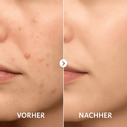 GlowSkin™ | Das virale Reispeeling für den wahren Glow