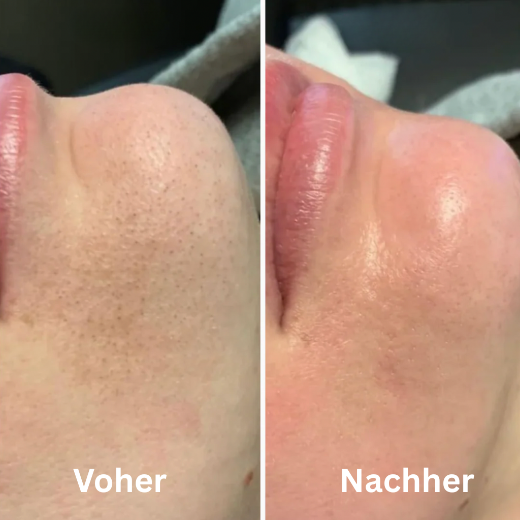 GlowSkin™ | Das virale Reispeeling für den wahren Glow