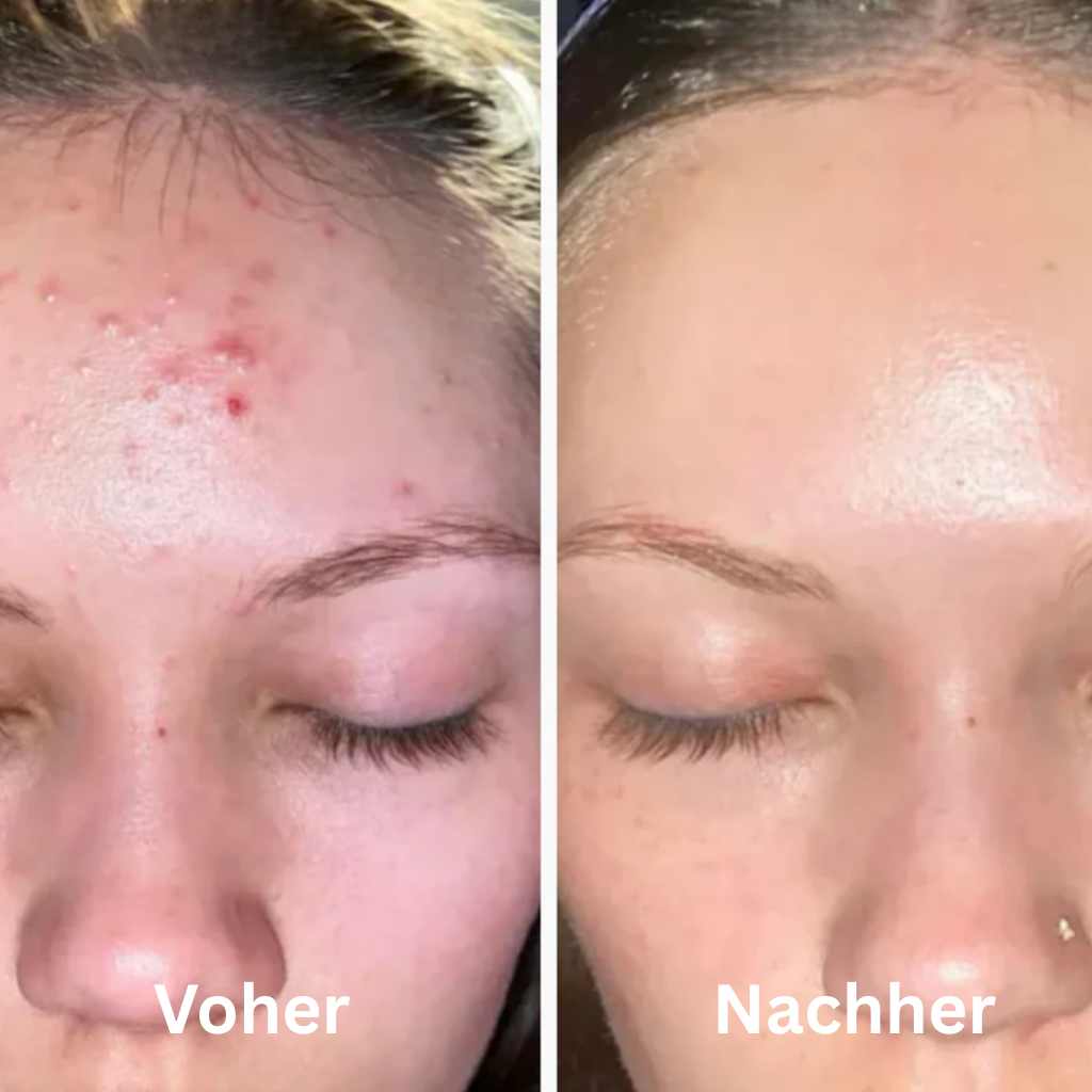 GlowSkin™ | Das virale Reispeeling für den wahren Glow